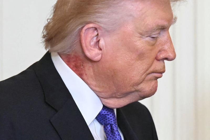 President Donald Trump looks on during a Medal of Honor ceremony in the East Room of the White House on March 2, 2026, in Washington, DC. President Trump awarded the Medal of Honor to retired Army Command Sgt. Major Terry P. Richardson, who served in the Vietnam War, posthumously to Army Master Sgt. Roderick W. Edmonds, who served in World War II, and posthumously to Staff Sgt. Michael Ollis, who died in combat in Afghanistan in 2013.