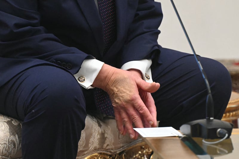 This photo shows the hands of US President Donald Trump as he meets with Turkish President Recep Tayyip Erdogan (unseen) at Bestepe Presidential Compound in Ankara, on July 7, 2026, on the sidelines of the NATO Summit. (Photo by SAUL LOEB / AFP via Getty Images)