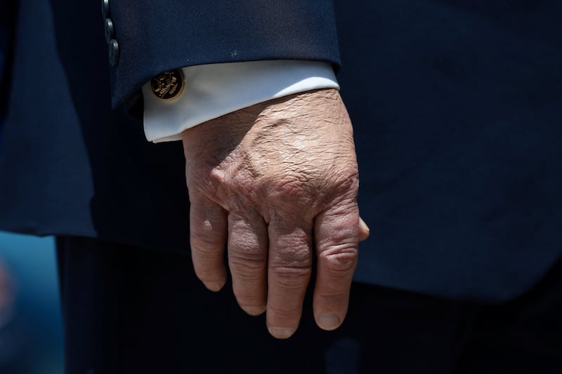 donald trump hand