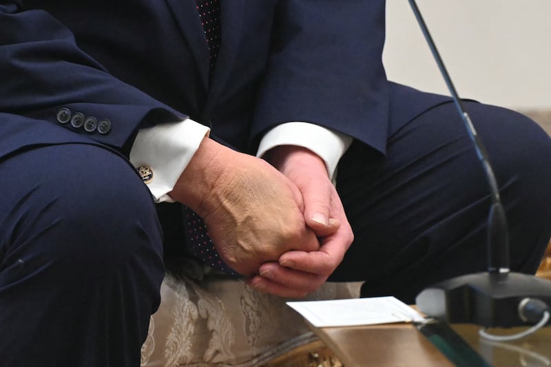 This photo shows the hands of US President Donald Trump as he meets with Turkish President Recep Tayyip Erdogan (unseen) at Bestepe Presidential Compound in Ankara, on July 7, 2026, on the sidelines of the NATO Summit. (Photo by SAUL LOEB / AFP via Getty Images)