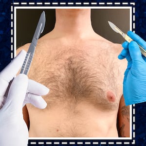 The Looker illo illustration for - This Plastic Surgery Gave Him The Confidence to Change Jobs