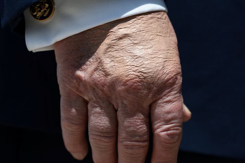 donald trump hand